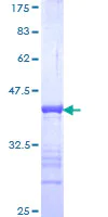 SDS-PAGE - Recombinant Human GATAD2B protein (AB153450)