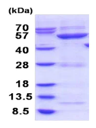 SDS-PAGE - Recombinant Human GBA3 protein (His tag) (AB187481)
