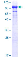 Recombinant Human GBP1 protein