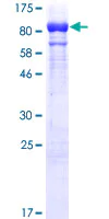SDS-PAGE - Recombinant Human GBP1 protein (AB114960)
