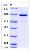 SDS-PAGE - Recombinant Human GBP1 protein (His tag) (AB276484)