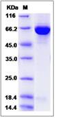SDS-PAGE - Recombinant Human GBP2 protein (His tag) (AB276602)