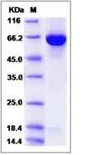 SDS-PAGE - Recombinant Human GBP2 protein (His tag) (AB276602)