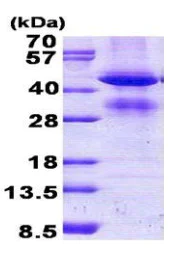SDS-PAGE - Recombinant Human GCAT protein (denatured) (His tag N-Terminus) (AB156971)