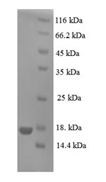 SDS-PAGE - Recombinant Human GCDFP 15 protein (His tag) (AB235867)