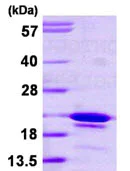 SDS-PAGE - Recombinant Human GCIP interacting protein p29 (AB113599)