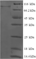 SDS-PAGE - Recombinant Human GCKR protein (Tagged) (AB225652)