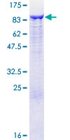 Recombinant Human GCLC protein