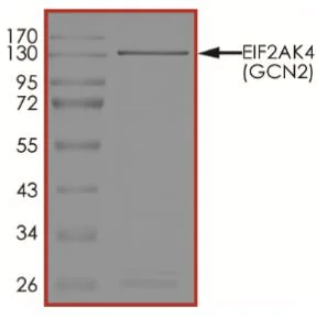 SDS-PAGE - Recombinant human GCN2 protein (Active) (AB268520)
