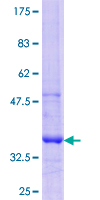 SDS-PAGE - Recombinant Human GCNT3 protein (AB160400), expandable thumbnail