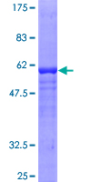 Recombinant Human GDAP1 protein