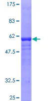 SDS-PAGE - Recombinant Human GDAP1 protein (GST tag N-Terminus) (AB162725)