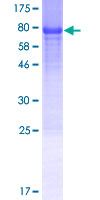 Recombinant Human GDAP2 protein