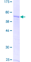 SDS-PAGE - Recombinant Human GDF 9 protein (AB158509)