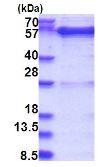 SDS-PAGE - Recombinant Human GDI1 protein (His tag N-Terminus) (AB181897)