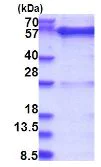 SDS-PAGE - Recombinant Human GDI1 protein (His tag N-Terminus) (AB181897)
