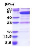 SDS-PAGE - Recombinant Human GDI2 protein (His tag N-Terminus) (AB180348)