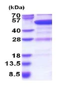 SDS-PAGE - Recombinant Human GDI2 protein (His tag N-Terminus) (AB180348)