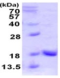 SDS-PAGE - Recombinant Human GDX protein (His tag C-Terminus) (AB123144)