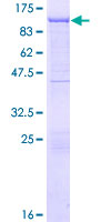 Recombinant Human Gelsolin plasma protein