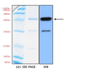 Recombinant Human Gelsolin protein (His tag)