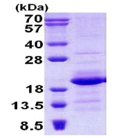 SDS-PAGE - Recombinant Human Gemin6/SIP2 protein (His tag N-Terminus) (AB140556)