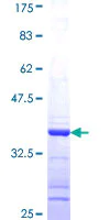 SDS-PAGE - Recombinant Human Gephyrin protein (AB153064)