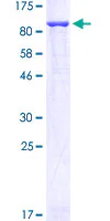 SDS-PAGE - Recombinant Human GFPT1 protein (AB152423)