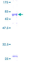 Recombinant Human GFR alpha 3/GFRA3 protein