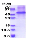 SDS-PAGE - Recombinant Human GFR alpha 3/GFRA3 protein (denatured) (His tag N-Terminus) (AB174556)