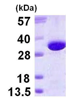 SDS-PAGE - Recombinant Human GGH protein (His tag N-Terminus) (AB123172)
