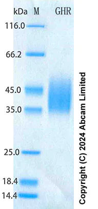 SDS-PAGE - Recombinant Human GHR Protein Standard (His tag) (AB316661)