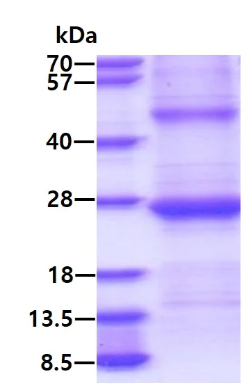 SDS-PAGE - Recombinant Human GILT protein (His tag N-Terminus) (AB134622)