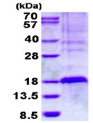 SDS-PAGE - Recombinant Human GilZ / TilZ protein (His tag N-Terminus) (AB134597)