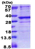 SDS-PAGE - Recombinant Human GIMAP5 protein (His tag N-Terminus) (AB171714)