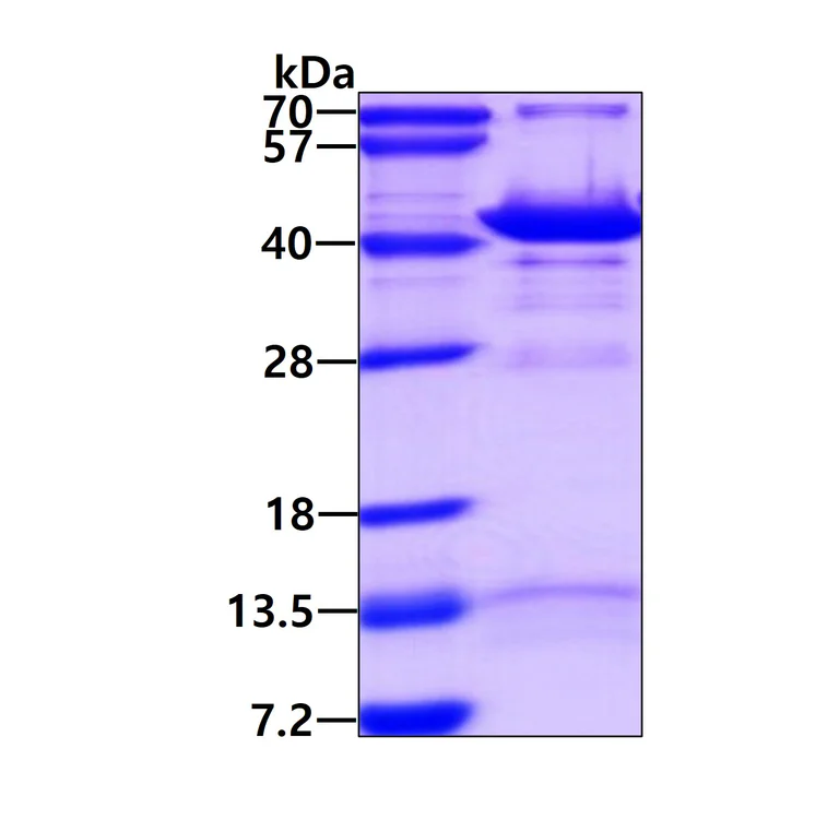 SDS-PAGE - Recombinant Human GIPC1 protein (His tag N-Terminus) (AB96769)