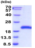 SDS-PAGE - Recombinant Human GITR protein (AB208317)