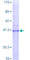 SDS-PAGE - Recombinant Human GJB2 protein (AB152424)