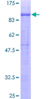 SDS-PAGE - Recombinant Human GLEPP1/PTPRO protein (AB114815)