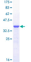 Recombinant Human Gli1 protein