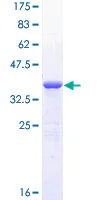 SDS-PAGE - Recombinant Human Gli1 protein (GST tag N-Terminus) (AB152427)