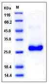 SDS-PAGE - Recombinant Human GLIPR1 protein (His tag) (AB276331)