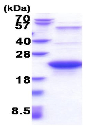 Recombinant human GLO1 protein