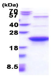 SDS-PAGE - Recombinant human GLO1 protein (AB206792)