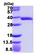 SDS-PAGE - Recombinant Human GLOD4 protein (His tag N-Terminus) (AB109939)
