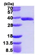 SDS-PAGE - Recombinant Human GLOD4 protein (His tag N-Terminus) (AB109939)