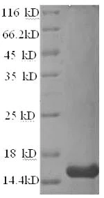 SDS-PAGE - Recombinant Human GLP-1R protein (His tag) (AB239555)
