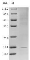 SDS-PAGE - Recombinant Human GLP-1R protein (His tag) (AB267911), expandable thumbnail