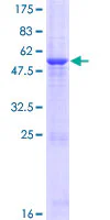 SDS-PAGE - Recombinant Human GLT1D1 protein (GST tag N-Terminus) (AB165511)
