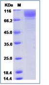 SDS-PAGE - Recombinant Human GLTP protein (His tag) (AB276609)